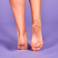 Calcetines Peeling y Exfoliantes  2ud.-204420 Calcetines Peeling y Exfoliantes  2ud.-204420 3